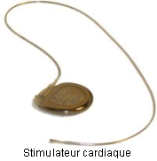 Un stimulateur cardiaque