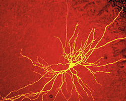 Photographie : neurone prélevé dans l'hippocampe d'un rat, sone du cerveau impliquée dans certaines épilepsies