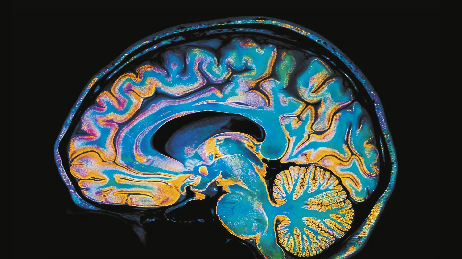vue de coupe d'un cerveau humain colorisé par l'IA