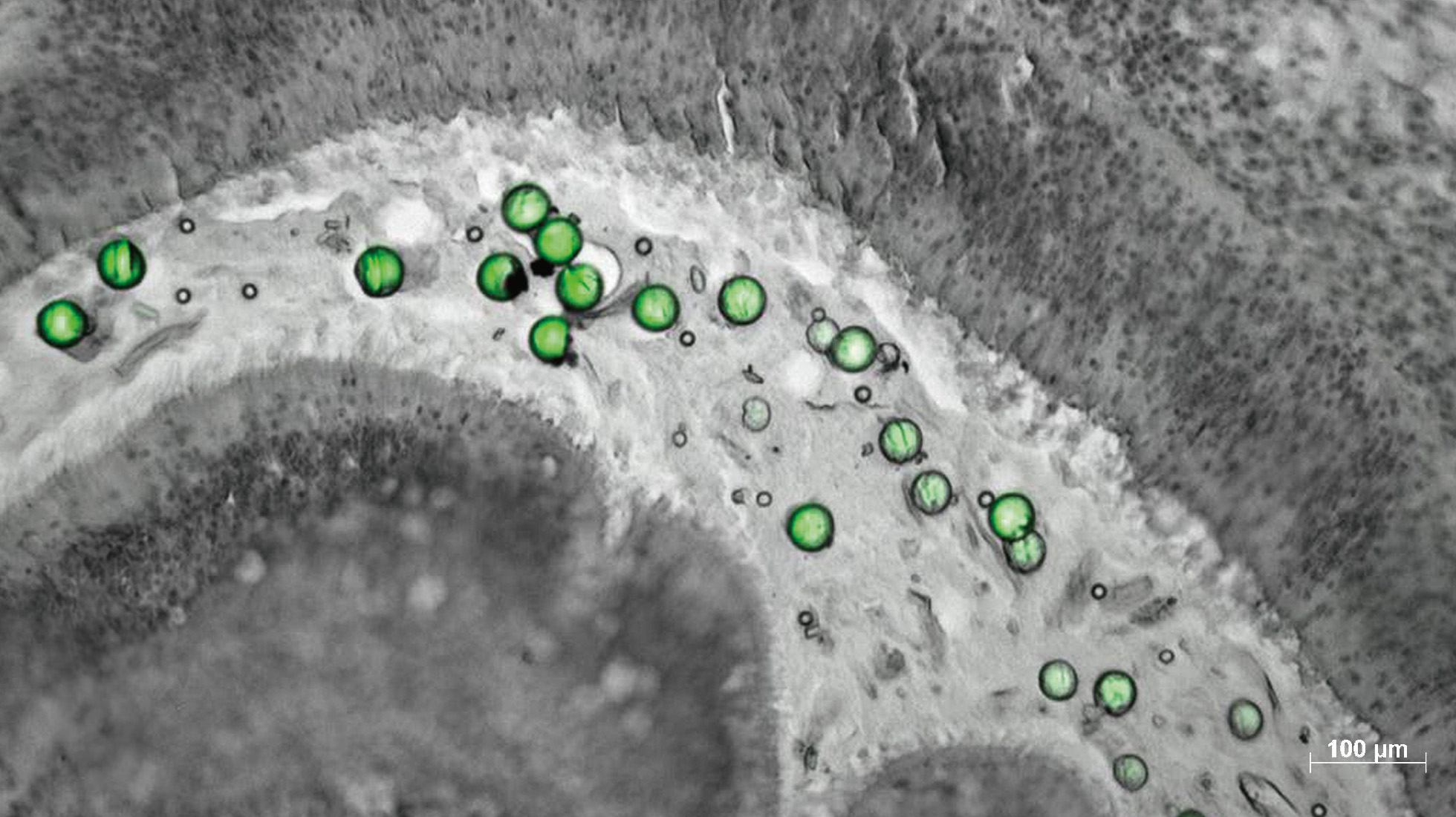 microbilles de polystyrène